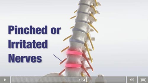 Chiropractic Spinal Degeneration